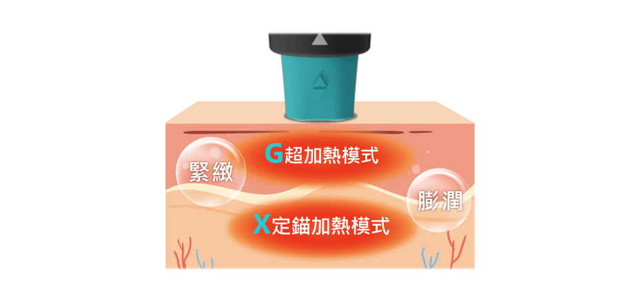 GXG-全面深淺層加熱